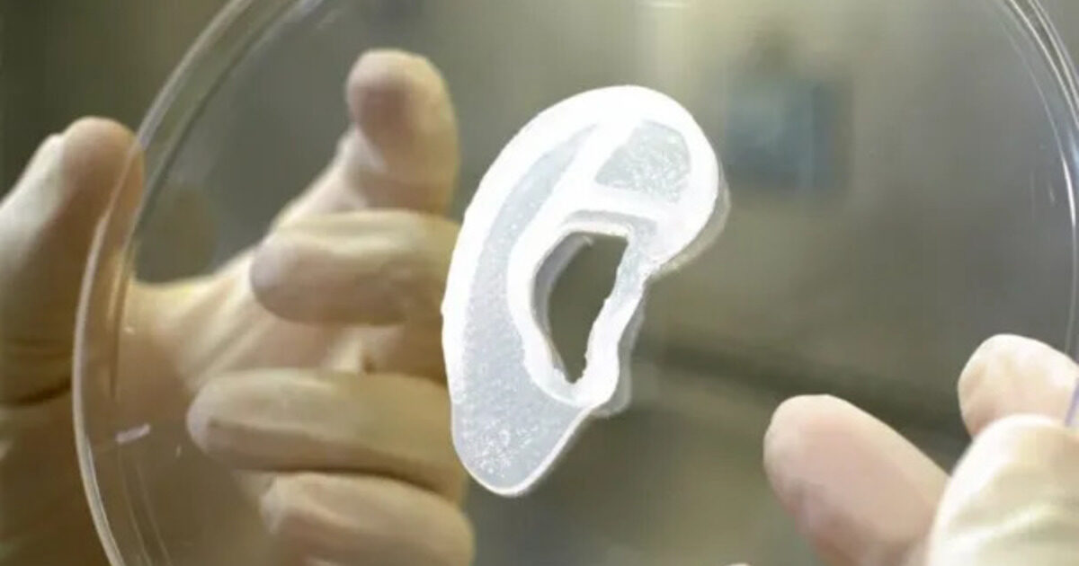 Человеку впервые пересадили напечатанное на 3D-принтере ухо