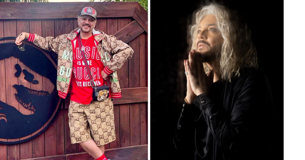 До и после: как пластика изменила Филиппа Киркорова