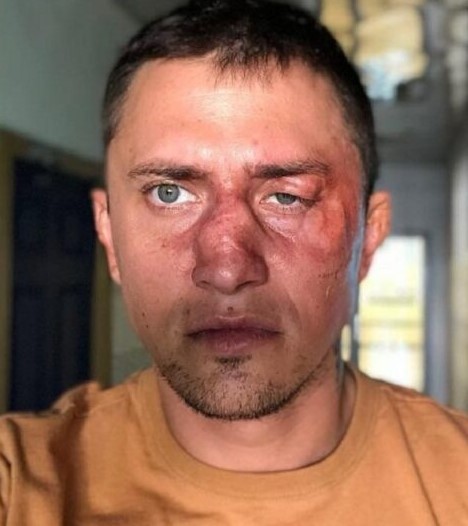 Суд неожиданно отменил приговор бизнесмену, избившему Прилучного